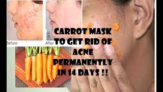 DIY Homemade Carrot facial Face Mask for Acne - Acne treatment