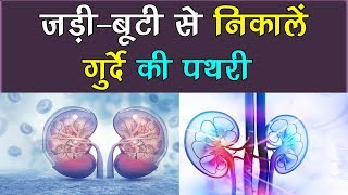 आयुर्वेदिक तरीके से पक्का निकल जाएगी पथरी  Kidney Stone Can Be Flushed Away By BR Health Tips