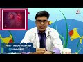 যেসকল কারণে আপনারও হতে পারে স্ট্রোক stroke symptoms u0026 treatment stroke hole ki korben