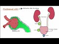 Acute Kidney Injury (AKI) - Prerenal,Intrarenal,Postrenal