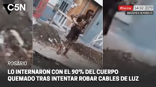ROSARIO: lo INTERNARON con el 90% del CUERPO QUEMADO tras intentar ROBAR CABLES de LUZ