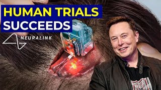 Elon Musk's Neuralink Human Trials: Merging Brain And Computer | AI Tech Academy