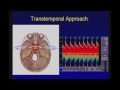 Transcranial Doppler How To Do It – Applications from Fetal Life to Brain Death