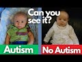12 Signs of Autism in Babies