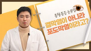 [망막] 방치하면 실명까지 부르는 포도막염의 진단과 치료