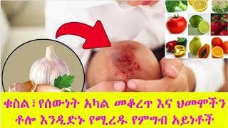 ቁስል፣የሰውነት አካል መቆረጥ እና ህመሞችን ቶሎ እንዲድኑ የሚረዱ የምግብ አይነቶች