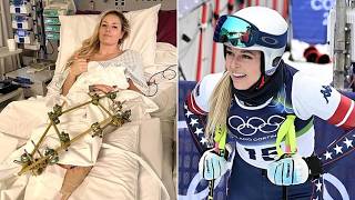 Lindsey Vonn Fires Back at Fans Over Retirement Talk After Olympic Crash That Nearly Cost Her Leg