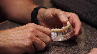 FAQ - How can I make my dentures fit better? | Antoon Family Dental