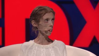 Nostalgia | Lene Marie Fossen & Morten Krogvold | TEDxArendal