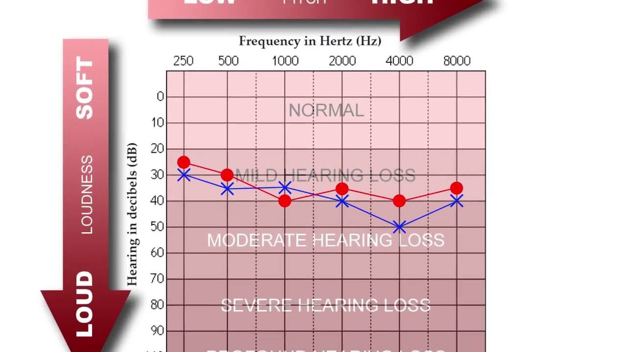 How To Read An Audiogram Youtube