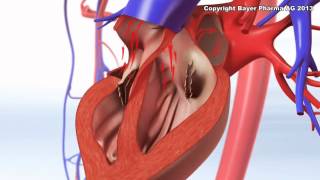 Afib Introduction