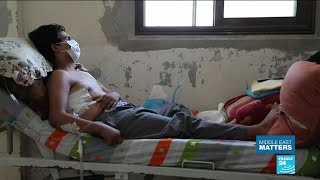 The battle for Idlib: Inside an hospital of the rebel stronghold