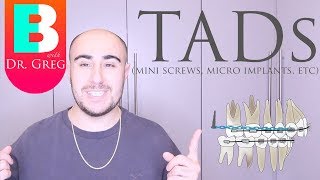 [BRACES EXPLAINED] TADs / Mini Implants