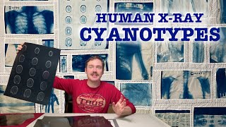 Quilt made of HUMAN  X-RAYS?? Cyanotype Quilt