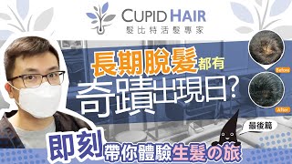 【⚠️竟然... 可以徹底解決脫髮，頭瘡❗】活髮療程 @Cupid Hair [旺角活髮專家]