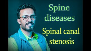 03 Spine diseases: Spinal canal stenosis