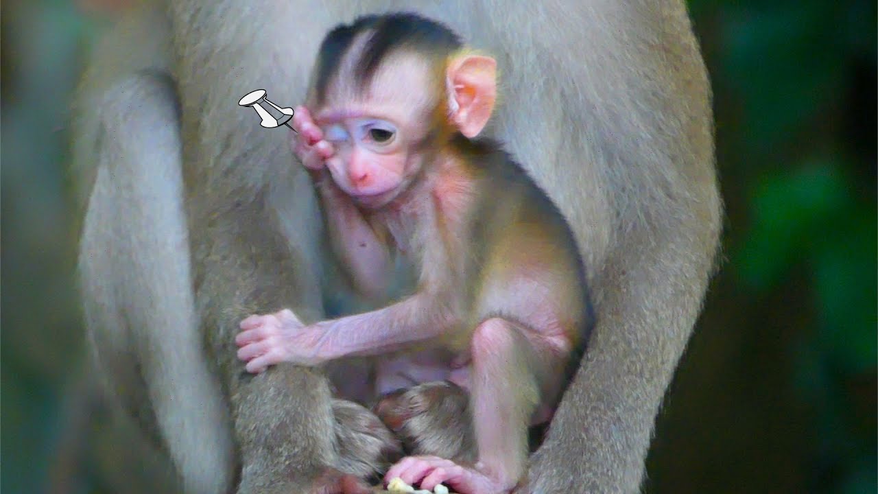 Perhaps something stay on one eye make baby of mom BRENDY pulling close one eye