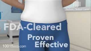 Introduction to CoolSculpting - Avatar Video