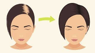 Haarausfall: 3 bewährte Hausmittel gegen Haarausfall (komplette Anleitung)