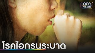 ไอกรนอันตรายถึงชีวิต | ข่าวเช้าช่องวัน | สำนักข่าววันนิวส์