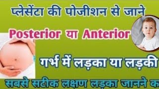 प्लेसेंटा की पोजीशन से जाने गर्भ में लड़का या लड़की। Placenta posterior/ anterior means boy or girl