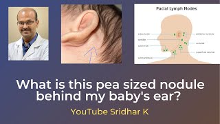 What is this pea like swelling behind my baby’s ears? Sridhar K #lymphnode #nodule #babyswelling