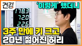 운동과 교정으로만 키가 다시 커지고 청년 허리로 돌아간 40대 남자│갑자기 줄어드는 키가 보내는 위험 신호│척추 바르게 세우는 법│귀하신 몸│#EBS건강