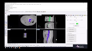 Tutorial: Segmentation (Region growing)