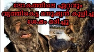 ലോകത്തിലെ ഏറ്റവും വൃത്തികെട്ട മനുഷ്യൻ കുളിച്ച ശേഷം മരിച്ചു @HIGHRANGEVISION8748