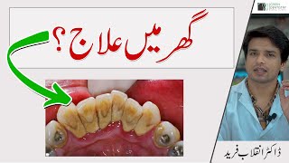 Home Remedies of DENTAL TARTAR? | دانتوں پر جمی پتھر کا گھر میں علاج ممکن ہے ؟