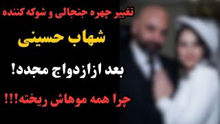 💥شهاب حسینی : از کَچل شدن تا عاشق شدن دوباره !