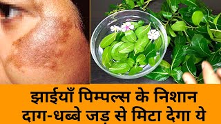 चेहरे की झाईयां झुर्रियॉँ दाग-धब्बे Pigmentation जड़ से ख़त्म 100% रिजल्ट | How to Pigmentation Spots