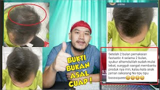 TESTIMONI REAL TUH YA YANG ADA CHATTINGAN-NYA!! 2 BULAN DOANG UDAH BAGUS LAGI! AUTO GANTENG!