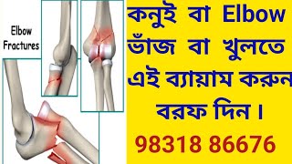 Elbow Extension Exercises after  Fracture. কনুই  ভাঙার  পরের ব্যায়াম.