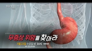 [생로병사의 비밀] 694회(19.05.22) 위암 예고👀