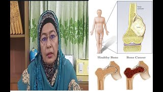 Bone cancer l হাড়ের ক্যান্সার