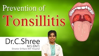 Hi9 | Prevention of Tonsillitis | Dr.C.Shree | ENT Surgeon