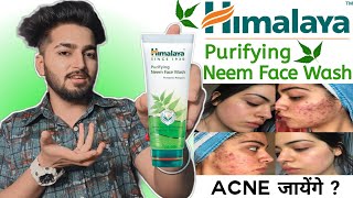 Himalaya Purifying Neem Face Wash Review | Himalaya Neem Face Wash For Acne, Pimples