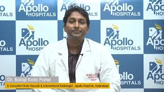 Are Spider Veins dangerous? How does it differ from Varicose Veins? | Apollo Hospitals