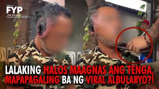 Lalaking halos maagnas ang tenga, mapapagaling ba ng viral albularyo? | FYP