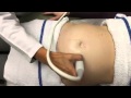 Ultrasound in Obstetrics & Gynecology: A Practical Approach - Clip 10.3