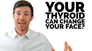 7 Ways Hypothyroidism Can Change Your Face