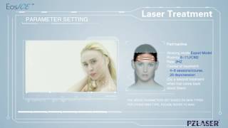 Eos-Ice Hair Removal Laser