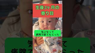 赤ちゃんの斜視が気になる #shorts  #乳児 #乳幼児 #内斜視 #偽斜視 #焦点 #生後3ヶ月 #寄り目 #なぜ #トラブル #不安 #心配 #かえでちゃんねる