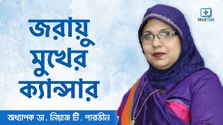 জরায়ু মুখের ক্যান্সার - Ovarian Cancer Treatment