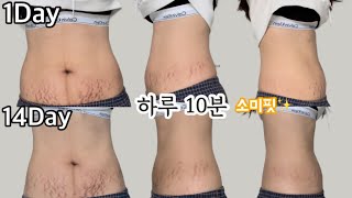 🔥복근운동🔥2주후기🔥하루10분🔥소미핏🔥처진 뱃살