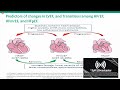 Management of Heart Failure with HFmEF