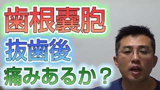 歯根嚢胞で抜歯になった後、痛みはあるのか？【根管治療】