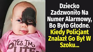 Dziecko Urodziło Się Z Ogromną Plamą Na Twarzy. Reakcja Rodziców Jest Szokująca...