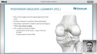 August 2017: Developments in the Management of PCL and Multi-ligament Knee Injuries